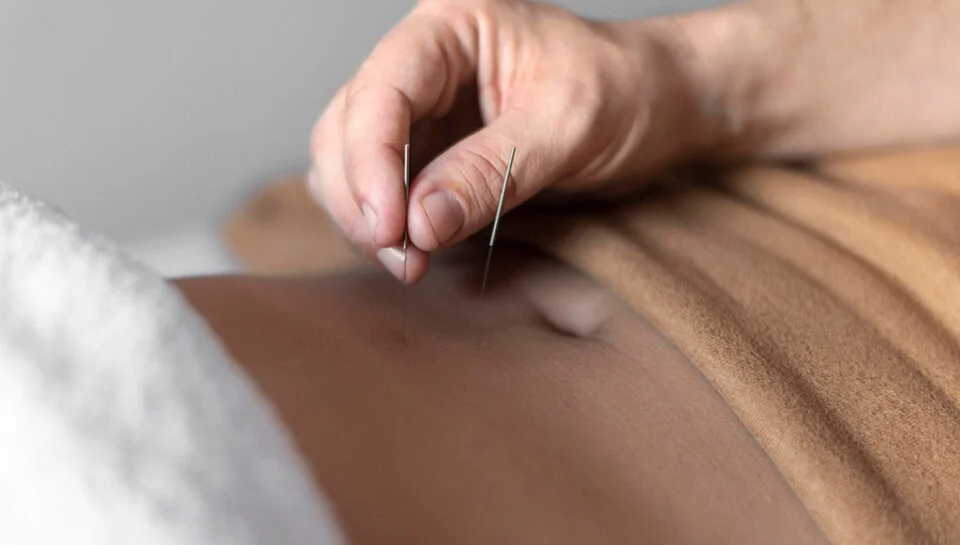 Dry Needling Certified in Richmond