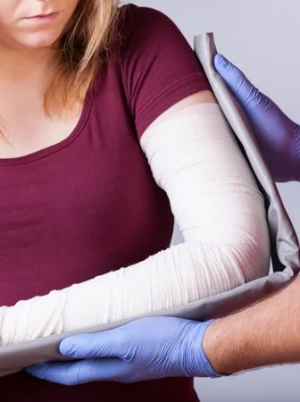 Elbow fracture