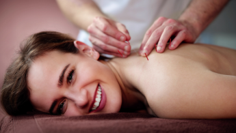 dry needling therapy
