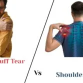 Rotator Cuff Tear Vs Shoulder Sprain Shoulder Sprain Vs Rotator Cuff Tear
