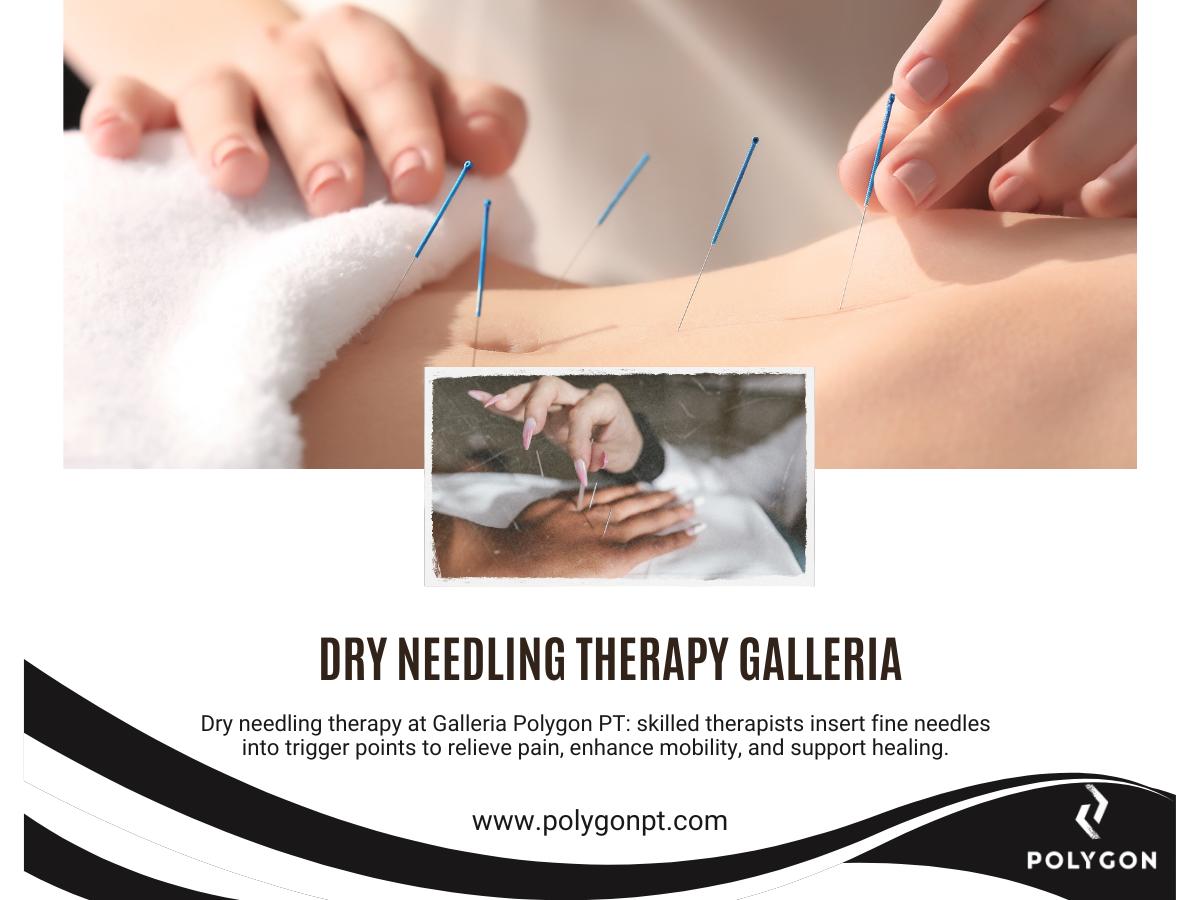 Physical therapist performing dry needling therapy on a patient in a clinical setting