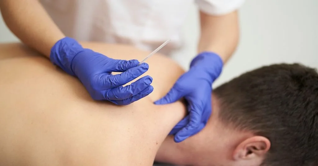 Dry Needling Benefits: What This Treatment Can Actually Do for You